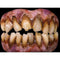 Buy Costume Accessories zombie Horror Teeth sold at Party Expert